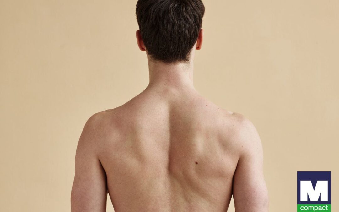 Depilación masculina laser diodo