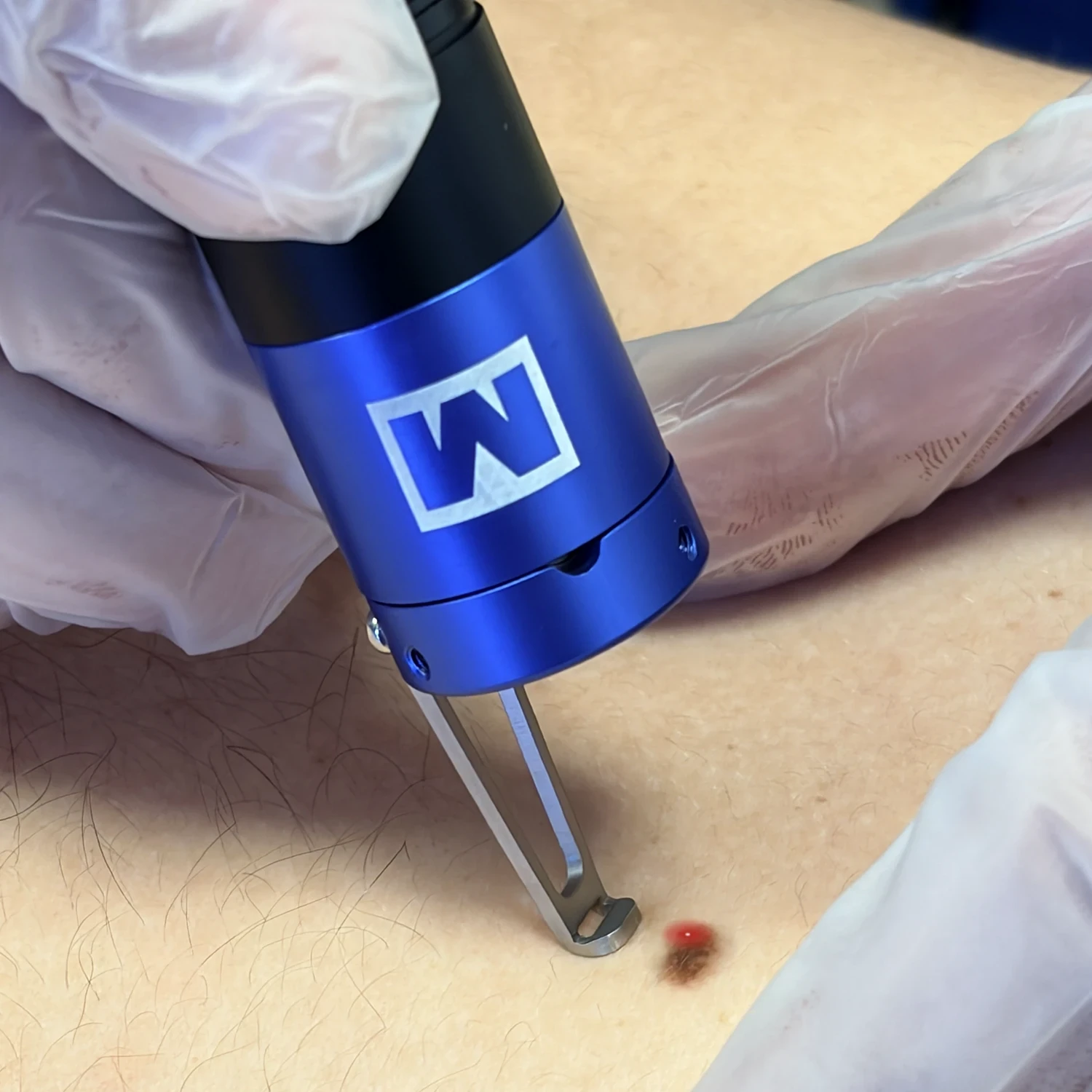 Laser Azul Laser Azul